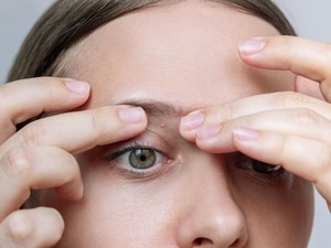 7 Cara Menghilangkan Milia di Wajah yang Aman dan Alami
