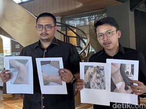 Menanti Penetapan Tersangka Pelaku KDRT Viral di Surabaya
