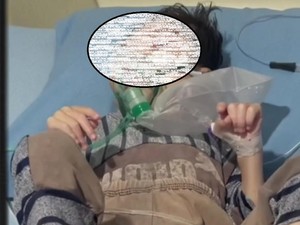 Miris! Bocah 4 Tahun di Palembang Alami Gizi Buruk, Ortu Susah Urus KIS