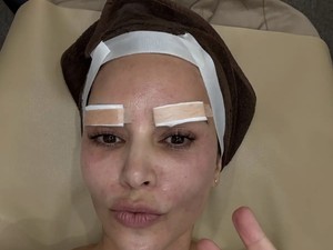Kim Kardashian Perawatan Kecantikan Ekstrem di Korea, Ada Suntik Darah