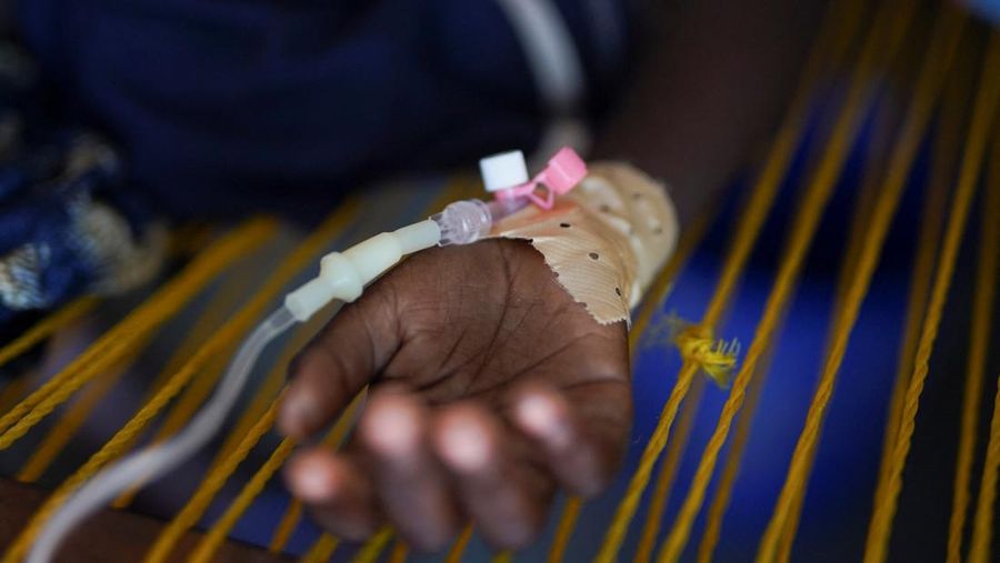 Infus medis seorang pasien kolera Sudan, terlihat saat ia berbaring di tempat tidur di klinik darurat yang dikelola Perserikatan Bangsa-Bangsa, di Tawila, Darfur utara, Sudan, 5 Agustus 2025. (REUTERS/Mohammed Jamal)