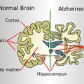 Studi Baru Ungkap Gaya Hidup yang Bisa Mengurangi Risiko Alzheimer