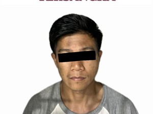 Pensiunan Polisi Australia Jadi Korban Penganiayaan-Pencurian di Legian