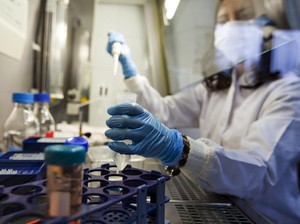 Muncul Lagi Setelah 3 Tahun Mereda, Wabah Ebola di Kongo Tewaskan 15 Warga