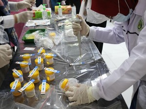FK Unair & RSUD Dr Soetomo Gelar Pemeriksaan TB-LAM Urine di Sampang