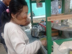 Yuk Bantu Resti, Anak Tukang Batagor Penderita Tumor Butuh Uluran Tangan