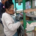 Kisah Resti Ridiyanti, Anak Tukang Batagor yang Menderita Tumor