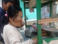 Kisah Resti Ridiyanti, Anak Tukang Batagor yang Menderita Tumor