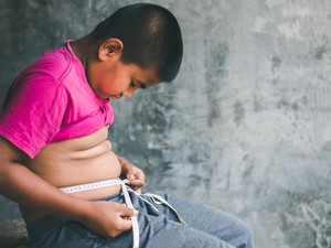 Indonesia Vs Obesitas, Double Burden di Tengah Masalah Gizi Anak