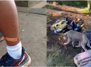 Anjing Ngamuk Gigit Belasan Pendaki Gunung Batukaru Positif Rabies