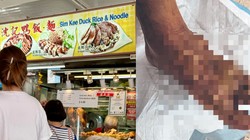 Gerai Nasi Bebek Legendaris Tutup usai Pemiliknya Tersiram Kuah Panas