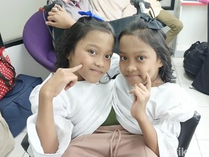 Kisah Kembar Siam Dewi-Putri asal Garut, Makan Bergantian karena Lambung Menyatu