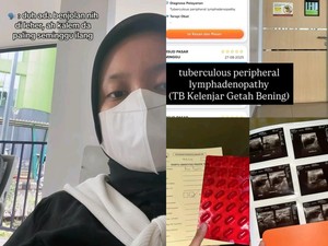 Viral Wanita Jaksel Kena TB Kelenjar Getah Bening di Usia 25, Awalnya Keluhkan Gejala Ini