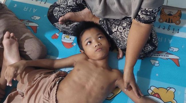 Meliuk Menahan Sakit, Anak ini Ditelantarkan Ibu karena Sakit Parah