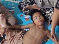 Meliuk Menahan Sakit, Anak ini Ditelantarkan Ibu karena Sakit Parah
