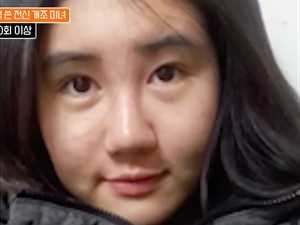 Foto Before-After Wanita Korea 400 Kali Operasi Plastik, Hasilnya Jadi Begini