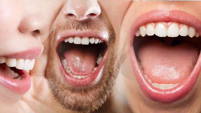 Hati-Hati, Makanan ini Ternyata Bisa Tingkatkan Risiko Kanker Mulut