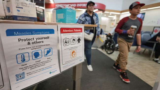 Ribuan Kasus Campak Guncang Kanada, Lockdown Mengintai