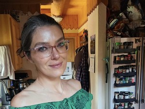Model Ini Ungkap Alami Kebotakan Akibat Di-makeover Tyra Banks