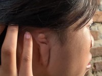 China Cetak Sejarah Baru, Telinga Copot Dipasang ke Kaki