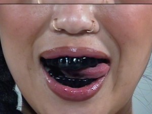 Teeth Blackening, Tren Gigi Hitam yang Kembali Populer di Kalangan Gen Z