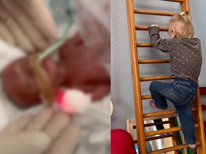 Kisah Haru Balita Tumbuh Sehat Setelah Lahir Prematur di Usia 24 Minggu