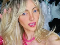 Influencer Barbie Meninggal Tak Wajar, Pernah 27x Operasi Plastik