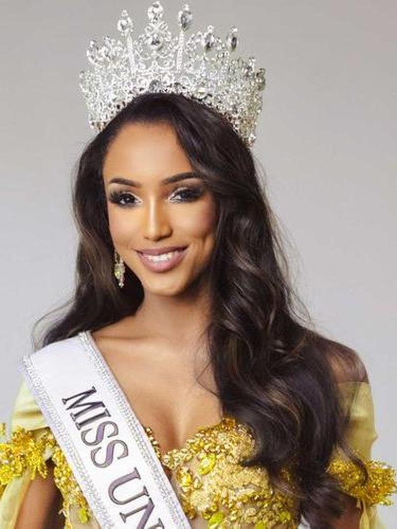 Kondisi Terkini Miss Jamaica Usai Jatuh di Miss Universe: Perdarahan Otak
