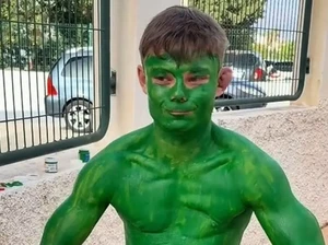 Turis Inggris Habiskan Tiga Hari Jadi Hulk gegara Insiden Tak Sengaja