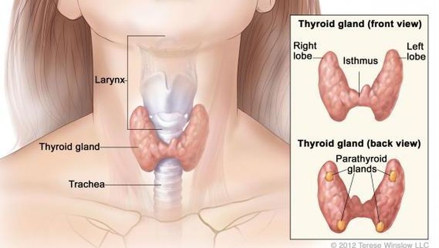 Kanker Tiroid. (Dok. rsonkologi)