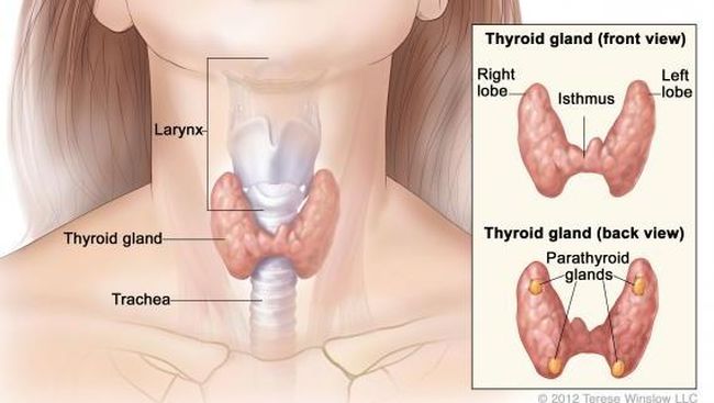 Ada Benjolan di Leher? Awas Bisa Jadi Gejala Kanker Tiroid