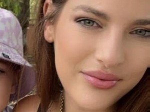 Impian Mirip Kylie Jenner Berujung Koma, Kisah Pilu Wanita yang Oplasnya Gagal