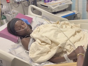 Supermodel Anok Yai Ungkap Penyakit Serius, Jalani Operasi Paru Robotik