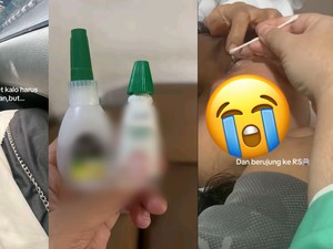 Viral Mau Pakai Tetes Mata Malah Tak Sengaja Ambil Lem, Endingnya Masuk RS