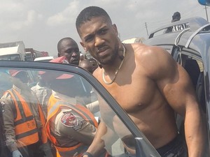 Anthony Joshua Trauma