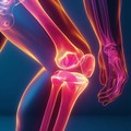 Mengenal Knee Arthroplasty, Prosedur Operasi untuk Gejala Nyeri Lutut