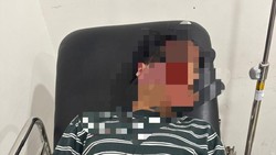 Pegawai Bank di Lampung Dianiaya Anak Purnawirawan Polri, Kepala Korban Luka