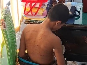 Anak Jalanan yang Diduga Dianiaya Oknum Konselor Rehabilitasi Lapor Polisi