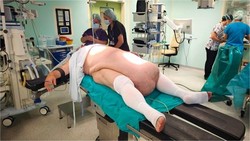 Perut Pria Ini Membesar Tak Wajar, Ternyata Ada Tumor Sebesar 32 Kg