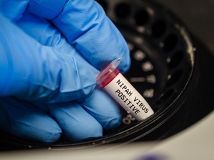 Sejumlah Bandara di Asia Siaga Virus Nipah!
