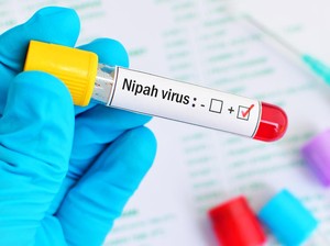 Video Negara di Asia yang Terapkan Protokol ala Covid-19 Gegara Virus Nipah