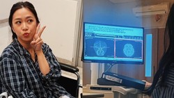 Kisah Wanita di Jaksel Kena Stroke di Usia 32, Awalnya Dikira Cuma Sakit Mata