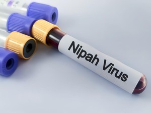 Kronologi Pasien Meninggal Terpapar Virus Nipah di Bangladesh, Keluhkan Gejala Ini