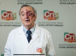 Viral Ilmuwan Spanyol Open Donasi demi Uji Klinis Kanker Pankreas, Butuh Segini