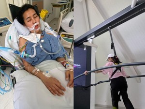 Kisah Wanita Jaksel Kena Tumor Otak di Usia 27, Ini Gejala Awalnya