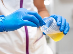 Gejala Ginjal Rusak Bisa Dilihat dari Urine, Ini Tanda-Tandanya