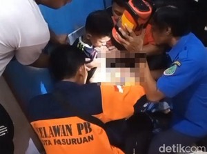 Bocah di Pasuruan Nangis Histeris Saat Kelamin Terjepit Ritsleting