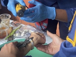 Saat Jam Tangan Menyerang Lengan Siti, Damkar Jadi Solusi