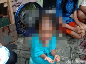 Fakta Baru Balita Dianiaya Paman-Bibi di Surabaya, Kepala Disulut Rokok