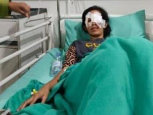 Pria di Palembang Diduga Tusuk Mata Istri Sirinya Pakai Cutter